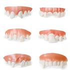 Gnarly Teeth -- Phony Teeth Collection